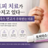토파타스 연고